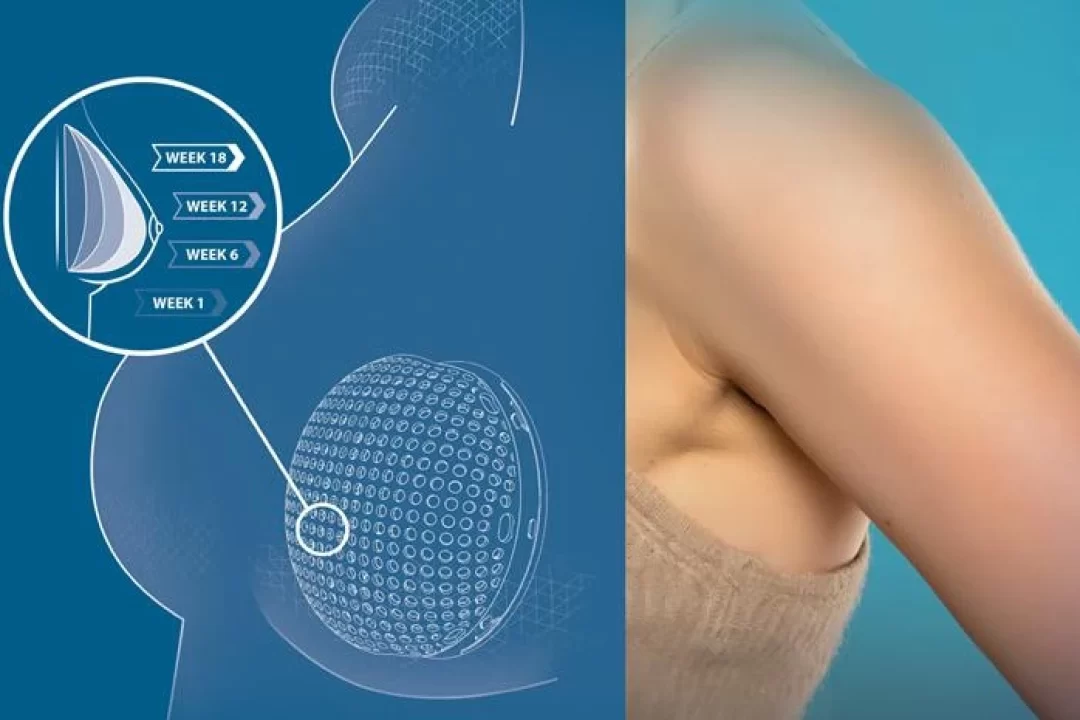 Los Gemelos Virtuales revolucionan la cirugía reconstructiva en el cáncer de mama