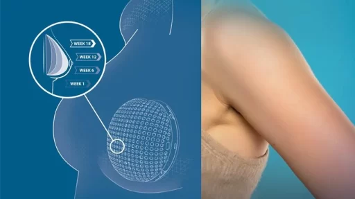 Los Gemelos Virtuales revolucionan la cirugía reconstructiva en el cáncer de mama